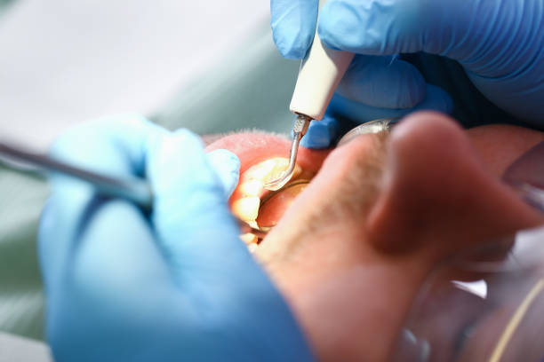 Best Urgent Dental Care in Bertsch Oceanview, CA