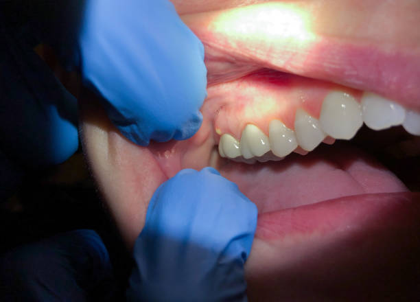 Best After-Hours Emergency Dentist in Bertsch Oceanview, CA