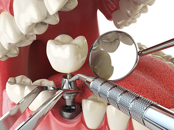 Best 24-Hour Emergency Dentist in Bertsch Oceanview, CA